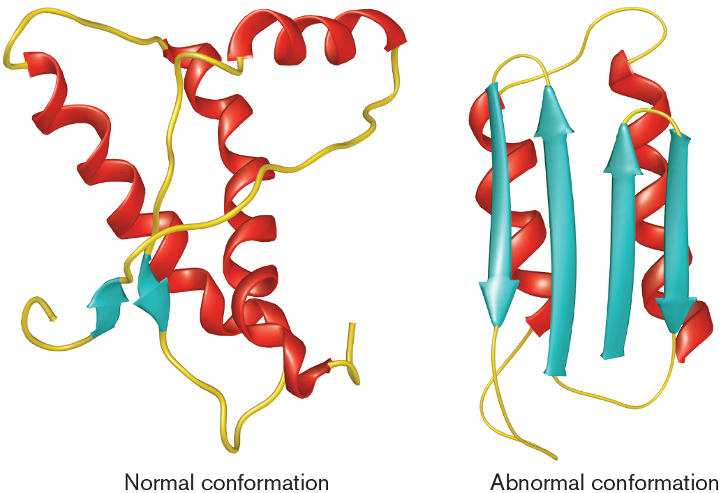 Solved: Prions Are Aberrant Proteins That Cause Creutzfeld... | Chegg.com